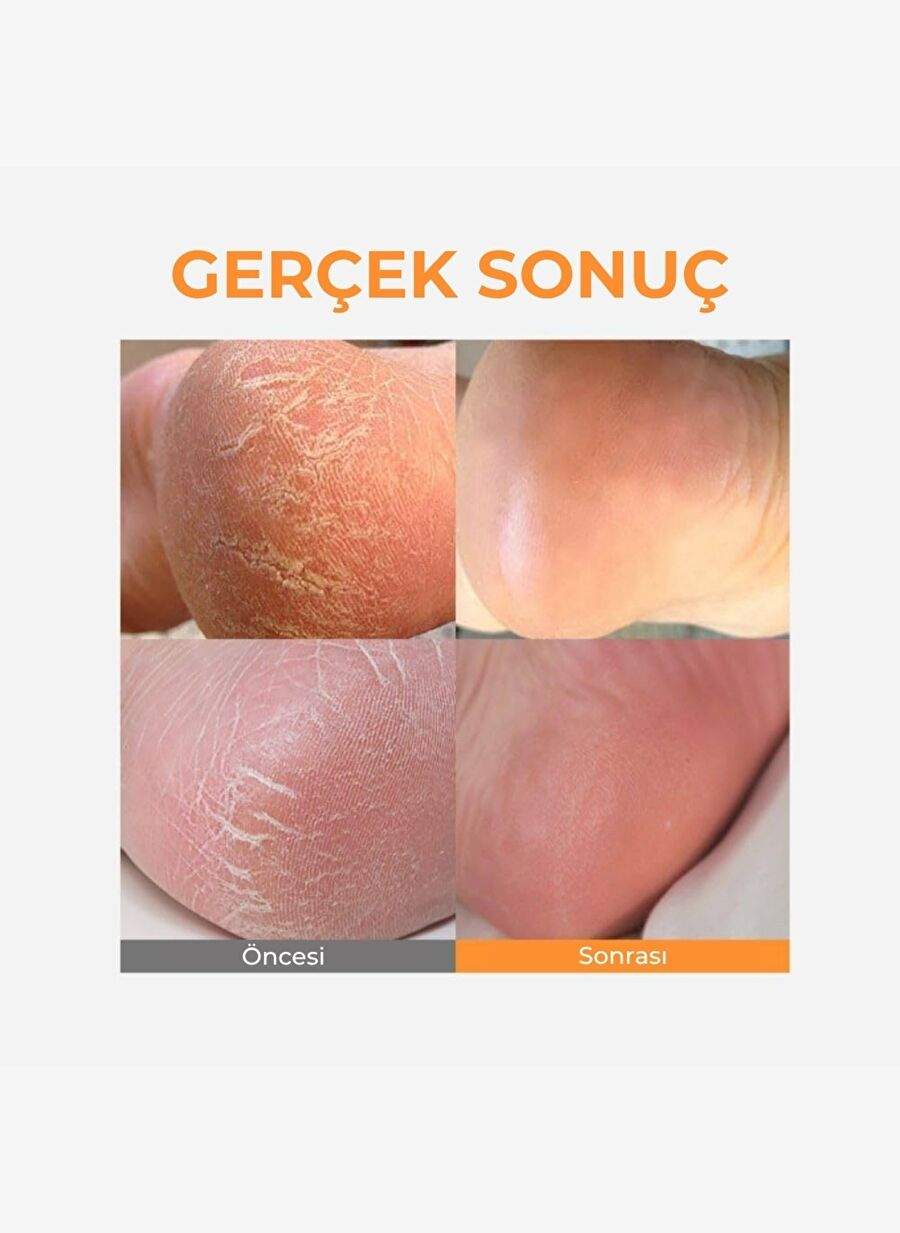 Sungboon LHA Baby Foot Scrub Stick - Ayak Peelingi — صورة المنتج 7 من 7